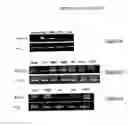 Fig. 08 - Methods and reagents for diagnosing and treating gliomas