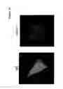 Fig. 20 - Methods and reagents for diagnosing and treating gliomas