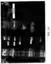 Fig. 14 - Tissue protective cytokine receptor complex, assays for identifying tissue protective compounds and uses thereof