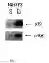Fig. 02 - Method for detecting carcinomas in a solubilized cervical body sample