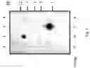 Fig. 02 - Hyaluronan synthase gene and uses thereof