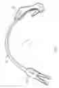 Fig. 02 - Spark plug boot removal tool