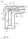 Fig. 11 - Over-voltage protection system
