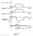 Fig. 08 - Steering control system for boat