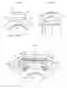 Fig. 02 - Tripod constant velocity universal joint