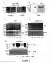 Fig. 02 - Compositions for the treatment of tumor pathologies, comprising internalin B (ln1B) of Listeria monocytogene protein or a fragment thereof