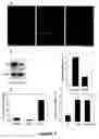 Fig. 07 - Compositions for the treatment of tumor pathologies, comprising internalin B (ln1B) of Listeria monocytogene protein or a fragment thereof