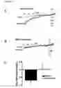 Fig. 07 - Methods and products for treating hypertension by modulation of TRPC3 channel activity