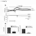 Fig. 16 - Methods and products for treating hypertension by modulation of TRPC3 channel activity