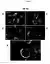 Fig. 09 - Compounds for the treatment of proliferative disorders