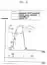 Fig. 11 - Fully-implantable cardiac recovery system