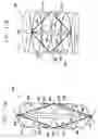 Fig. 20 - Fully-implantable cardiac recovery system