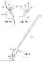 Fig. 06 - Pubovaginal sling implanter and procedure for the usage
