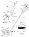 Fig. 09 - Pubovaginal sling implanter and procedure for the usage