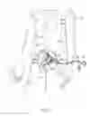 Fig. 02 - Trans-vascular surgical method and associated device