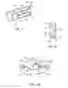 Fig. 04 - Trans-vascular surgical method and associated device