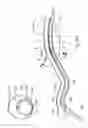 Fig. 16 - Illuminated surgical retractor