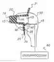 Fig. 01 - Ophthalmologic Applanation Prism Replacement System for Eye Examining Instrument