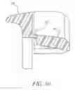 Fig. 07 - Ophthalmologic Applanation Prism Replacement System for Eye Examining Instrument