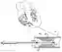 Fig. 01 - Method and apparatus for sizing stents