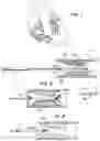 Fig. 02 - Method and apparatus for sizing stents