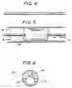 Fig. 03 - Method and apparatus for sizing stents