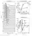 Fig. 03 - Method for automated analysis of submaximal F-waves
