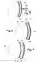 Fig. 04 - Appendage cover with inflatable ring and method of using same