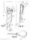 Fig. 06 - Appendage cover with inflatable ring and method of using same