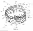 Fig. 02 - System and method for temporo-mandibular joint decompression during cervical traction