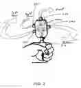 Fig. 04 - System and method for temporo-mandibular joint decompression during cervical traction