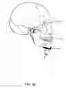 Fig. 09 - System and method for temporo-mandibular joint decompression during cervical traction