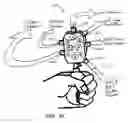 Fig. 32 - System and method for temporo-mandibular joint decompression during cervical traction