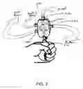 Fig. 04 - Inflatable spiral traction device, system, and method