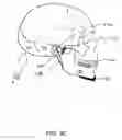 Fig. 08 - Inflatable spiral traction device, system, and method