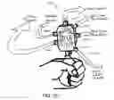 Fig. 32 - Inflatable spiral traction device, system, and method