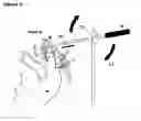 Fig. 03 - O'Gara pelvic reduction clamp