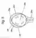 Fig. 06 - Surgical suction device