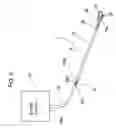 Fig. 07 - Surgical suction device