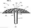 Fig. 07 - Infusion devices