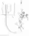 Fig. 05 - Drainage catheter hub with locking cam