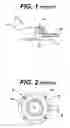 Fig. 02 - Method of implanting a subcutaneous injection port having stabilizing elements