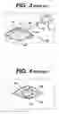 Fig. 03 - Method of implanting a subcutaneous injection port having stabilizing elements