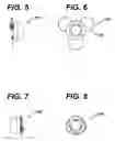 Fig. 04 - Method of implanting a subcutaneous injection port having stabilizing elements