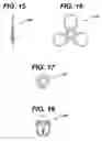Fig. 08 - Method of implanting a subcutaneous injection port having stabilizing elements