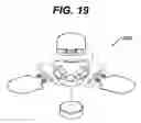 Fig. 09 - Method of implanting a subcutaneous injection port having stabilizing elements