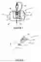 Fig. 04 - Device for securing a blood vessel cannula to a body