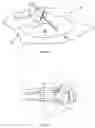 Fig. 06 - Device for securing a blood vessel cannula to a body