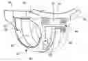 Fig. 01 - Disposable absorbent articles having multiple absorbent core components including replaceable components