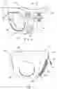 Fig. 04 - Disposable absorbent articles having multiple absorbent core components including replaceable components